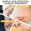 Satya Organic Eczema Balm - Easy Glide Eczema, Chafe Stick