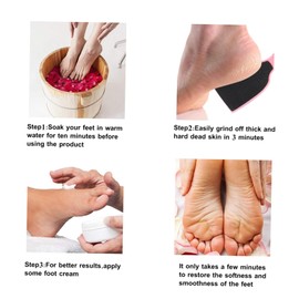 Baluue 2pcs Practical Pedicure Foot File Callus Scraper Dead Skin Remover Foot Tool