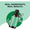 Maple Holistics Aceite Esencial Puro Eucalipto Para Difusor Y Masajes,