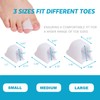Nolimvita Hammer Toe Straightener Corrector - Toe Spacers Toe Splints