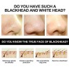 Mascarilla Exfoliante Eliminar Puntos Negros.