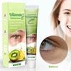 Vitamin E Milia Cream - Milia Daily Eye Care for