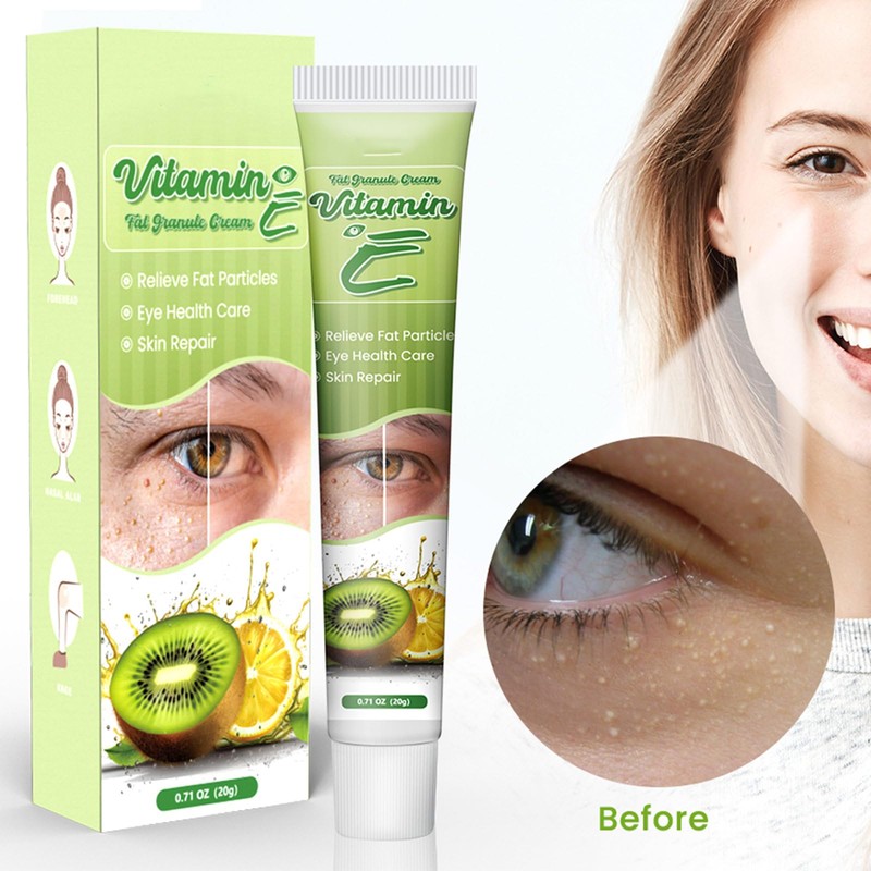 Vitamin E Milia Cream - Milia Daily Eye Care for