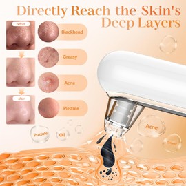 Yccu Mitesserentferner Porenreiniger Porensauger 4 Modi Pickelsauger Vakuumsauger zur Gesichtsreinigung Akne Behandlung Mitesser Sauger Hautpflege