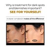 DEOPROCE DARK SPOT CLEAR CREAM 30ML