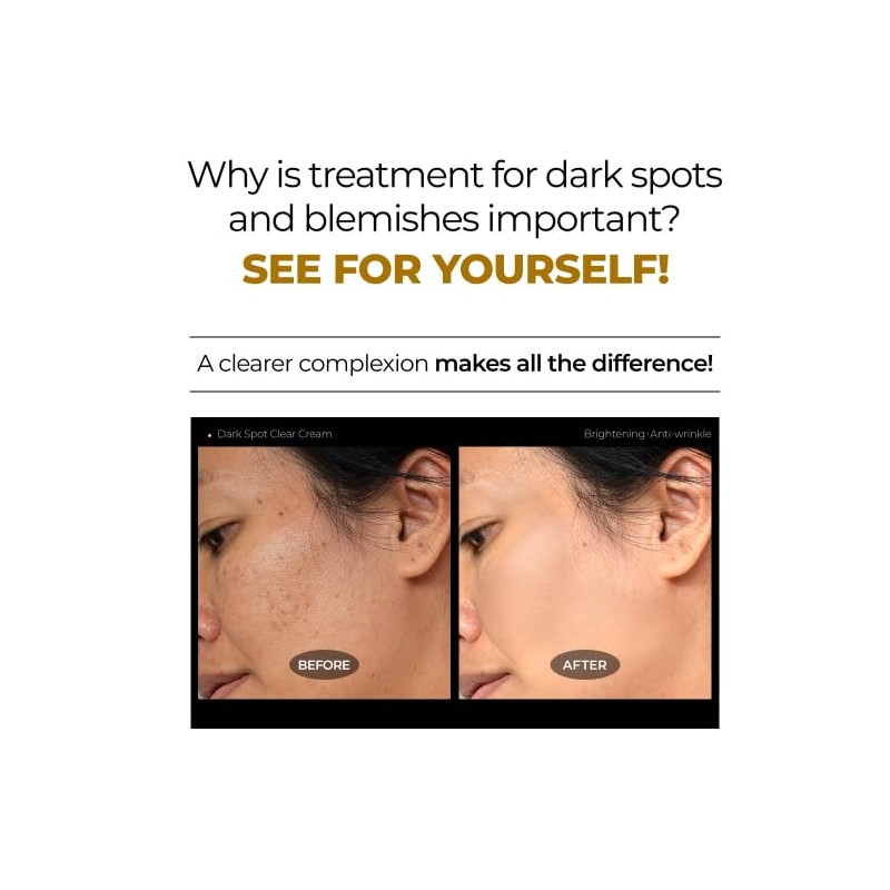 DEOPROCE DARK SPOT CLEAR CREAM 30ML