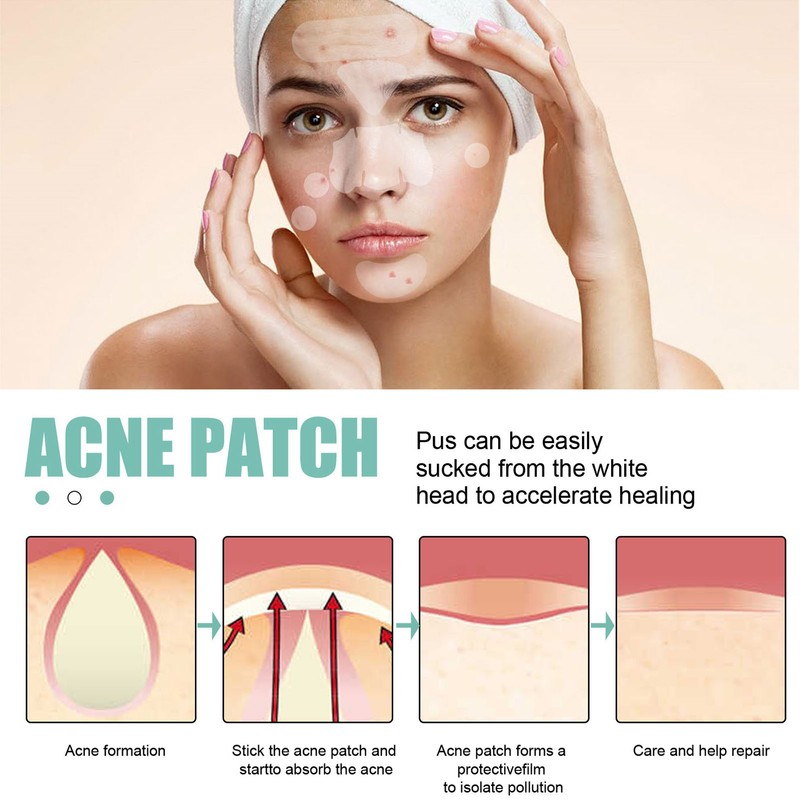 396Pcs Blemish Patches Facial Pimple Zit Spot Stickers Mild Non