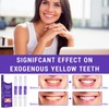 Thoquene Pack of 3 teeth whitening, teeth whitening, fast teeth