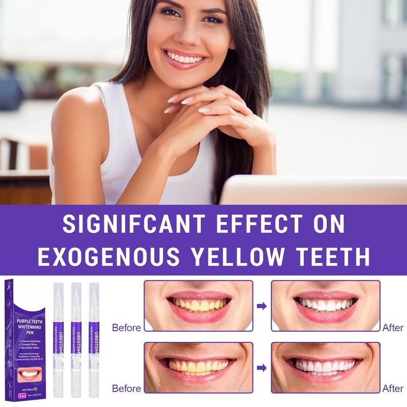 Thoquene Pack of 3 teeth whitening, teeth whitening, fast teeth