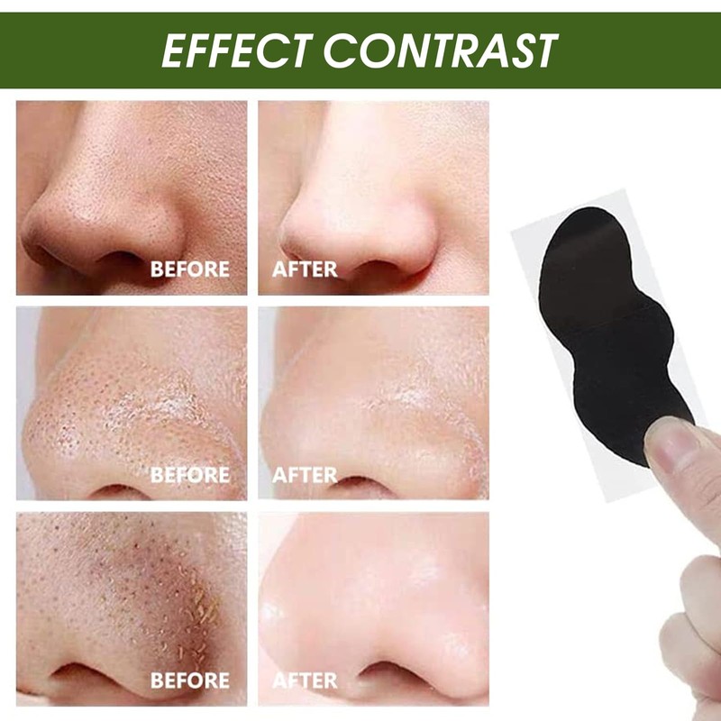 YANINEE 50PCS Mitesser Nase Pore Strips Nntfernen, Mitesserentferner Stripes für