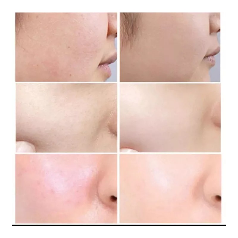 Eelhoe Granactive Retinoid 2% Emulsión 30ml