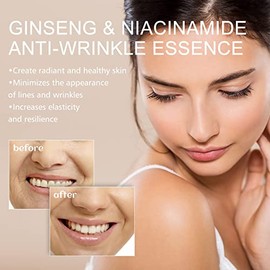 Ginseng Polypeptide Anti-wrinkle Essence, Ginseng Serum | Hyaluronic Acid Serum for Face | 3.4 Oz | Smoothes Fine Lines and Nasolabial Folds Around The Eyes, Firming and Moisturizing (1pc)
