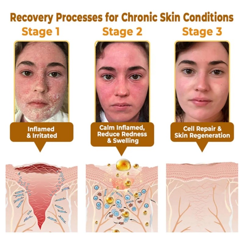 Crema Para Tratamiento Piel Daasry Bee, Restauración Piel2