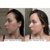 Kit Anti-edad: Retinol B3 C10 Hyalu B5 Niacinamide 10
