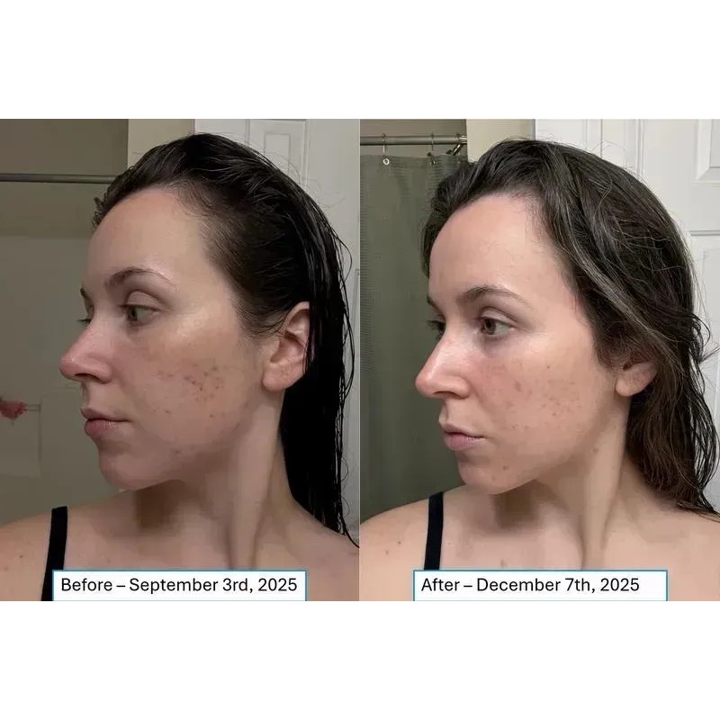 Kit Anti-edad: Retinol B3 C10 Hyalu B5 Niacinamide 10