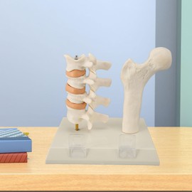 Osteoporosis Spine Model for Teaching and Demonstration, Visualize Bone Density Professional Anatomical Osteoporosis Model with Stand, for Educational Training Clinical Teaching