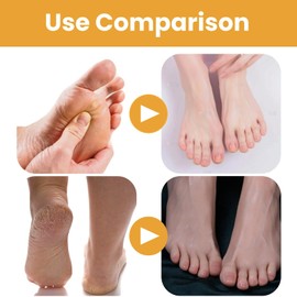 Crr/ystal Je/lly Foot Soak,Adorable Jel/ly Pedicure Packs ,Jell/y Spa F/oot Soak,Cry/stal Je/lly Fo/ot Soak-Moisturizing Foo/t Softening Soak,Jel/ly Pedicure Packs orange Foot Bath Salts(orange)