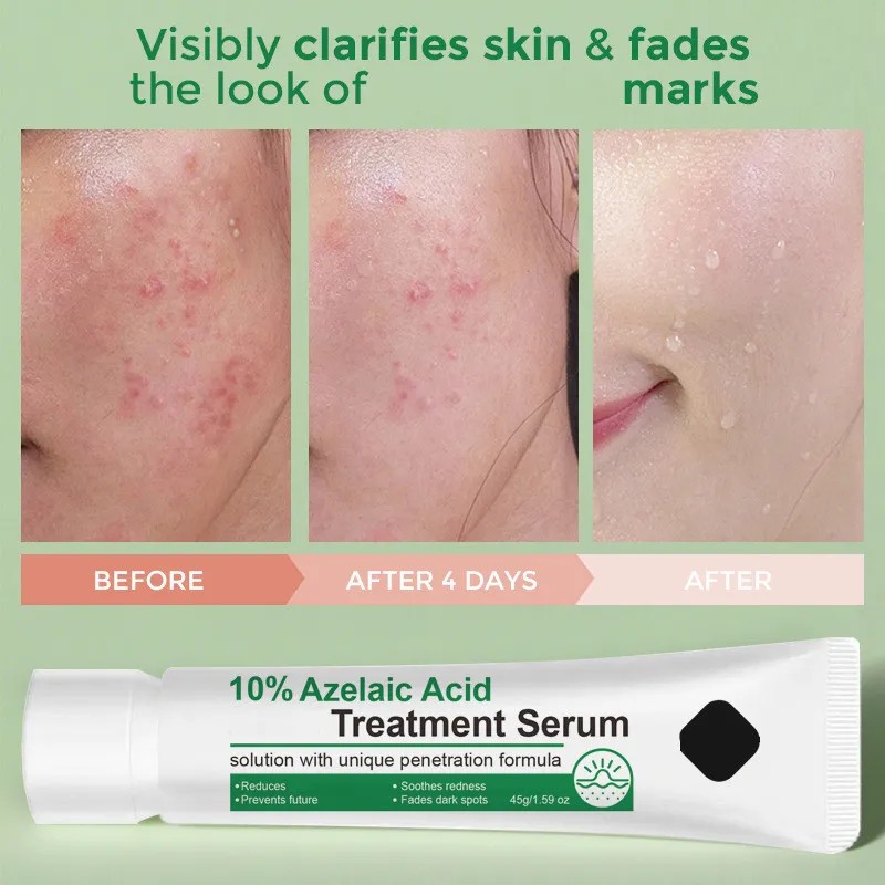 Srum Facial Azelaic 12 45 G Para El Cuidado De