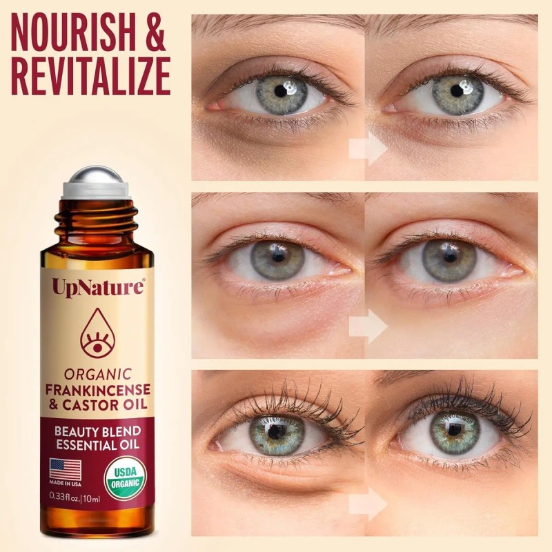 Upnature Aceite Ricino Incienso Contorno Ojos Roll On Ojeras