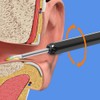 Rechargeable Ear Cleaner Wireless Visual Ear Wax Remover Ear Picking