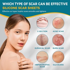 LINSIRON Silicone Scar Tape for Surgical Marks Face Stick Keloid Cover C-Section Strips Wrinkle Cream Lip Sleeping Gel Sheet Tummy Patch Hydrocolloid Roll Soft（1 Pack,1.6" x 60" ）