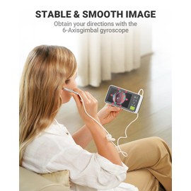 AnyScope 1080P Digital Otoscope with Gyroscope, 3.9mm Ear Scope Camera with 6 Lights, 4.5 Inches Screen, Ear Wax Removal Tool, 32GB Card, Supports Photo Snap and Video Recording