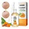 Suero Cúrcuma Facial Corporal Antiedad Manchas Hidratación