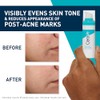 CeraVe Resurfacing Retinol Face Serum for Blemish-Prone Skin, 30ml