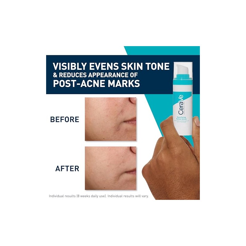 CeraVe Resurfacing Retinol Face Serum for Blemish-Prone Skin, 30ml