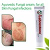 Lebrostone Ayurvedic cream for Fungal & Itchy Skin Care Cream,