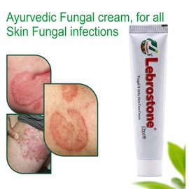 Lebrostone Ayurvedic cream for Fungal & Itchy Skin Care Cream, 100% Ayurvedic Formula, 25g