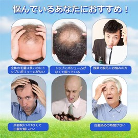 Wig Wig, Men's Black Hair, Short Wig, Business Room, Wig, Breathable, Natural, Aged, Gentle, Full Wig, Top Cover, Increased Hair, Hide Bald, Hair Removal, For Everyday Use, Medical Use, Fashion, One