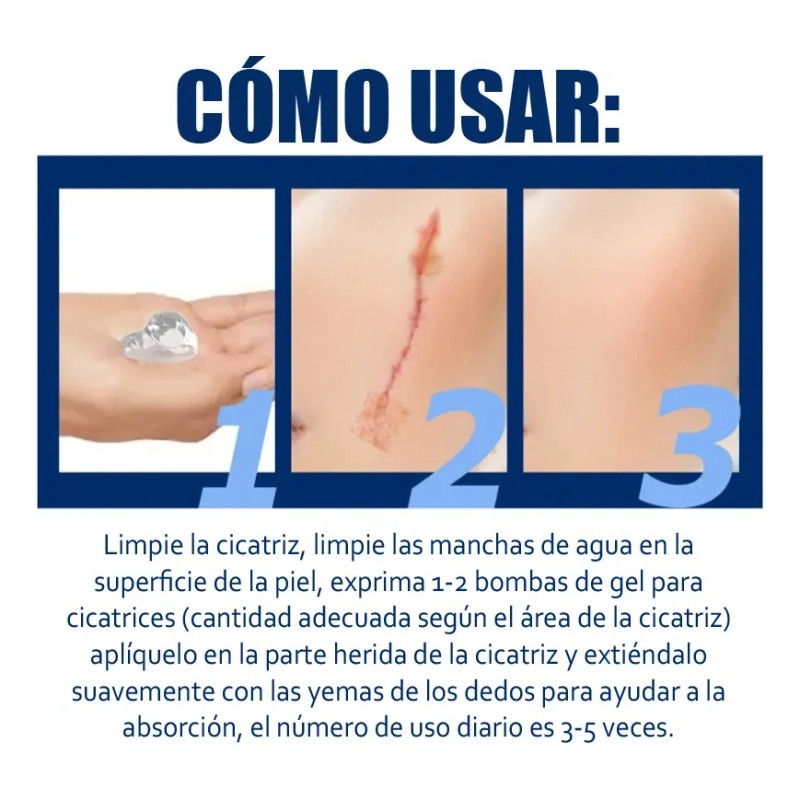 Gel De Silicona Para Eliminar Cicatrices De Cesárea Estrías Neutra