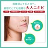 アクネバリア 薬用プロテクト ジェルクリーム 大人ニキビ 乾燥肌 保湿 予防 ハーブ ティーツリー 医薬部外品