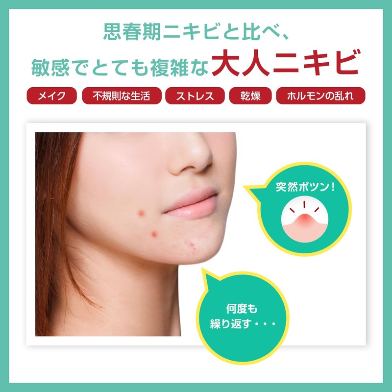 アクネバリア 薬用プロテクト ジェルクリーム 大人ニキビ 乾燥肌 保湿 予防 ハーブ ティーツリー 医薬部外品