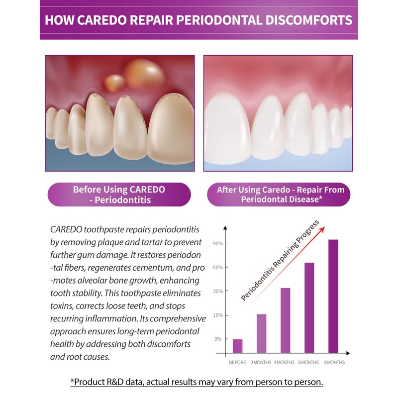 CAREDO Healing Periodontitis Treatment at Home Toothpaste, Periodontal Disease Treatment