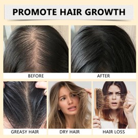 Batana Oil for Hair, 4-in-1 Liquid Batana Oil, with Rosemary, Pumpkin Seed Oil, Castor Oil, for Men and Women, Prevents Dry Hair & Hair Loss for All Hair Types (1Pcs)