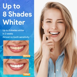 Teeth Whitening Kit, Teeth Whitening Kit with LED Light, Mouth Tray, 6 Gels for Whitening Teeth, 2 Desensitizing Gels