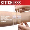 Emergency Wound Closure Strips - 2pk - Laceration Closure Kit