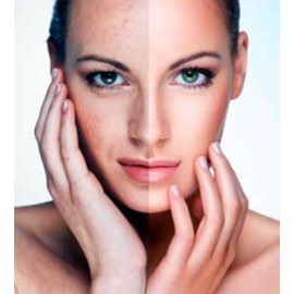 Collagina 10 Hydrolizado 100% Polvo BIO collagen colageno Fort arrugas 21