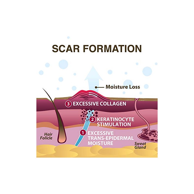 Scar Aid - Barra de silicona para tratamiento de cicatrices,