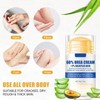 60% Urea plus 2% Salicylic Acid Foot Cream Moisturizer for