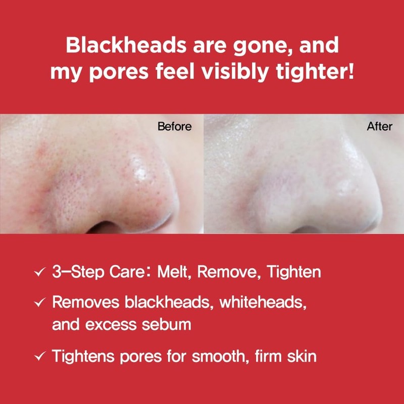 Nightingale 3-step Taco Pack Nose Deep Cleansing Pore Strip Systematic