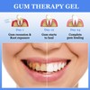 BSOON Gum Therapy Gel, Pack of 3 Teeth Whitening Pen