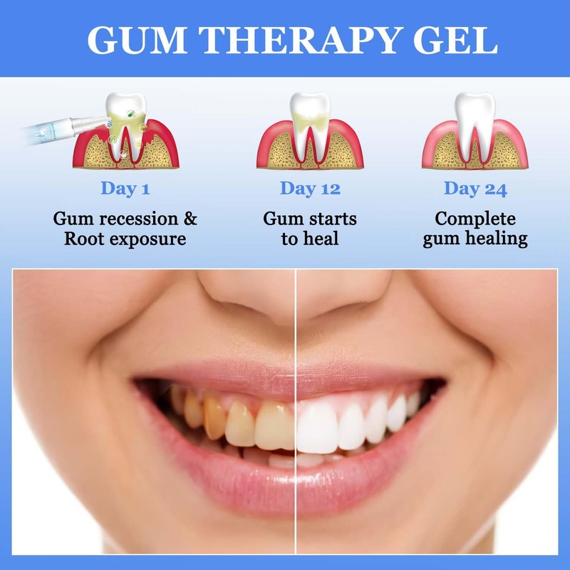 BSOON Gum Therapy Gel, Pack of 3 Teeth Whitening Pen