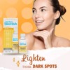Bye Bye Blemish Dark Spot Lotion Vitamin C | Assists