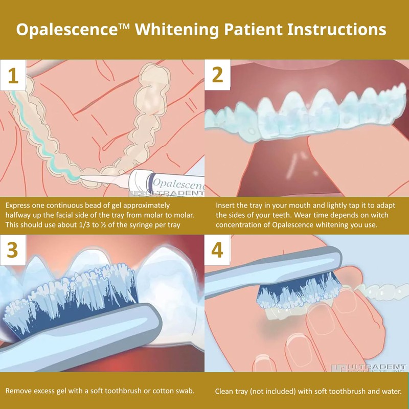 Opalescence 45% Syringes Teeth Whitening Gel - with PF -