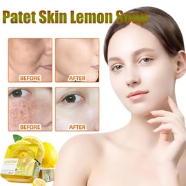 Patet Skin Soap, Patetskin Bright & Even Lemon Soap Bar, Patet Skin Essential Oil Soap Bars, Patet Skin Soap Bar, Patet Skin Care Soap Lemon Acid Soap for Hyperpigmentation, Dark Spots (Honey)