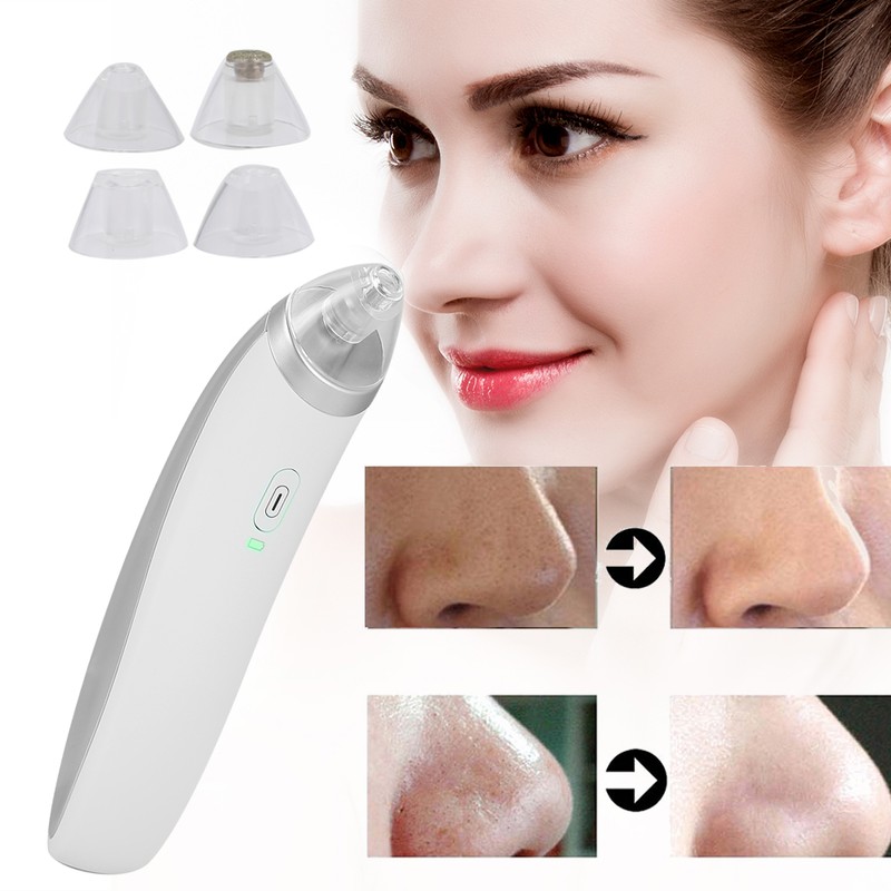 Electric 4‑In‑1 Blackhead Removal Pore Cleaner Suction USB Charging Face