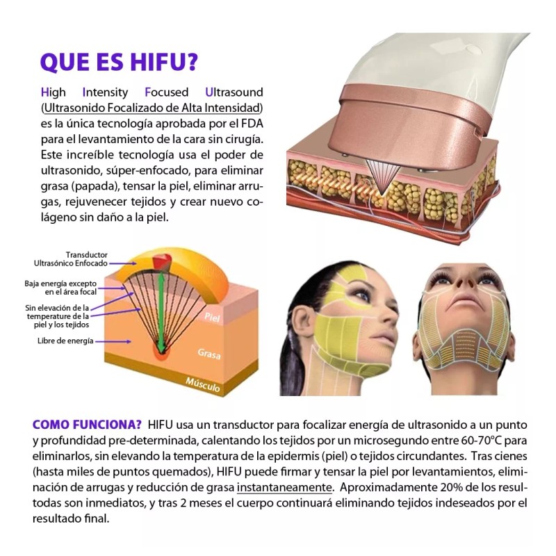 Aqua Aesthetics Mini Hifu Portatil Radiofrecuencia Ultrasonido Rf Facial V2